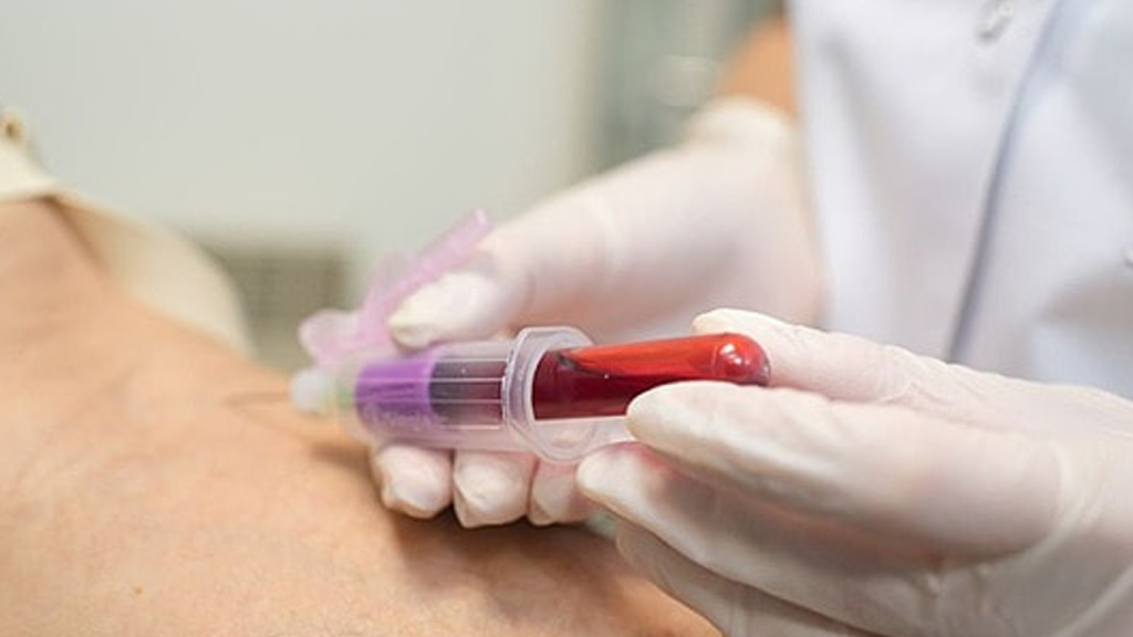 فواید خونگیری