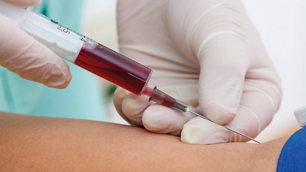 فواید خون گیری