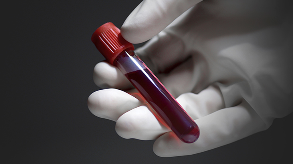 فواید خون گیری