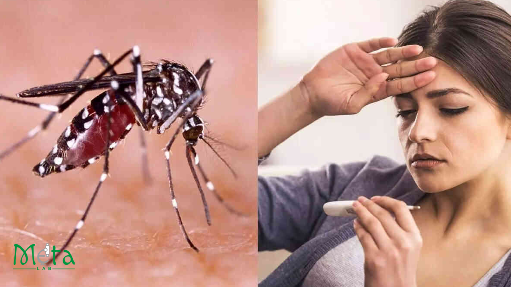 علائم بیماری تب دنگی