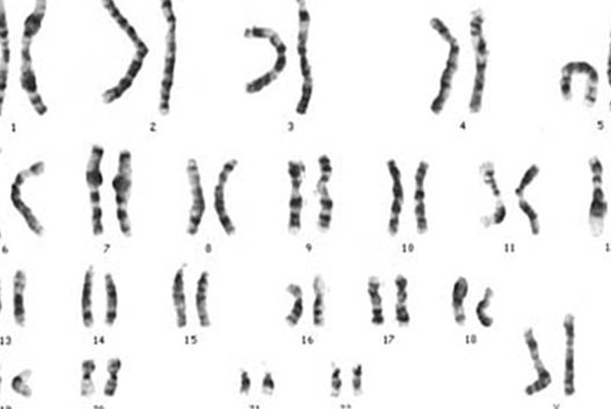 karyotype test