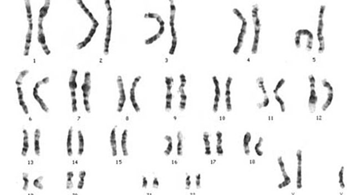 karyotype test