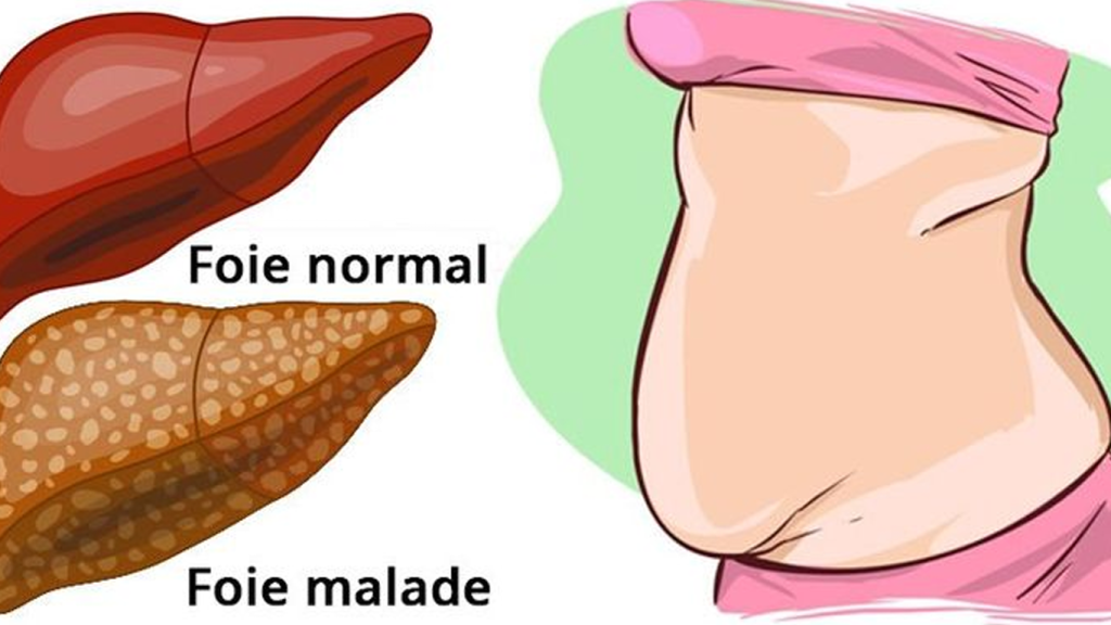 انواع گرید کبد چرب
