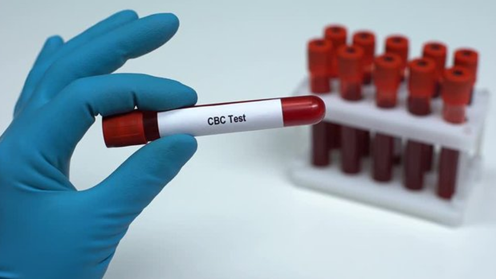 آزمایش cbc