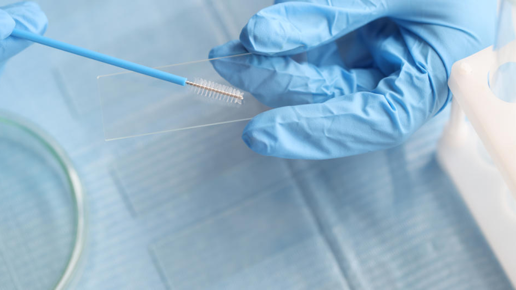 تفاوت تست hpv و پاپ اسمیر