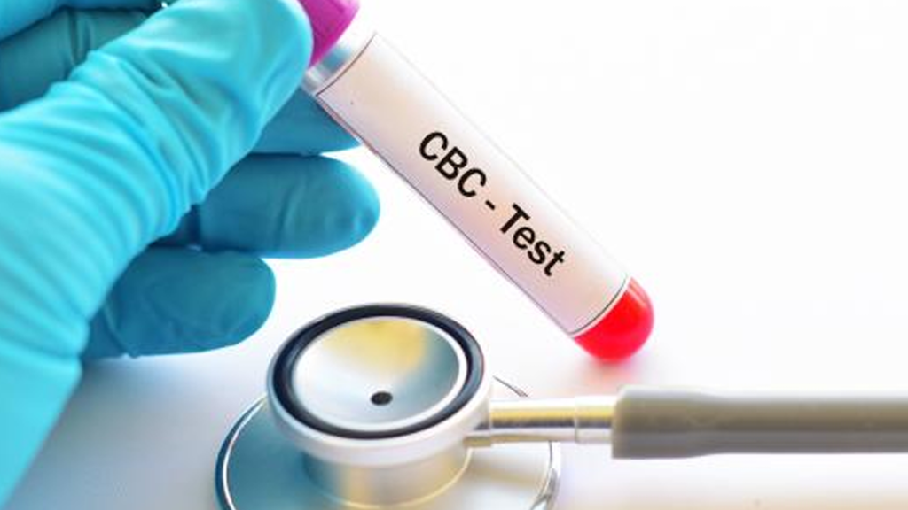 آزمایش cbc