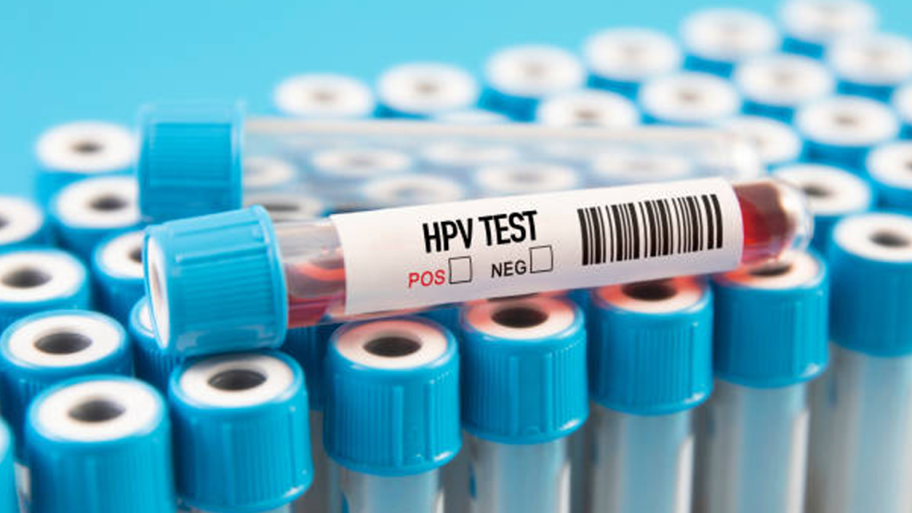 تفاوت تست hpv و پاپ اسمیر