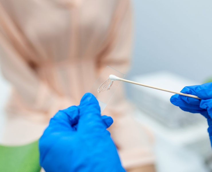 تفاوت تست hpv و پاپ اسمیر