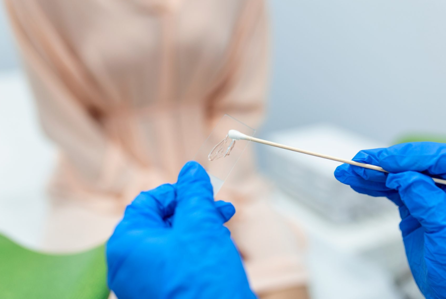 تفاوت تست hpv و پاپ اسمیر