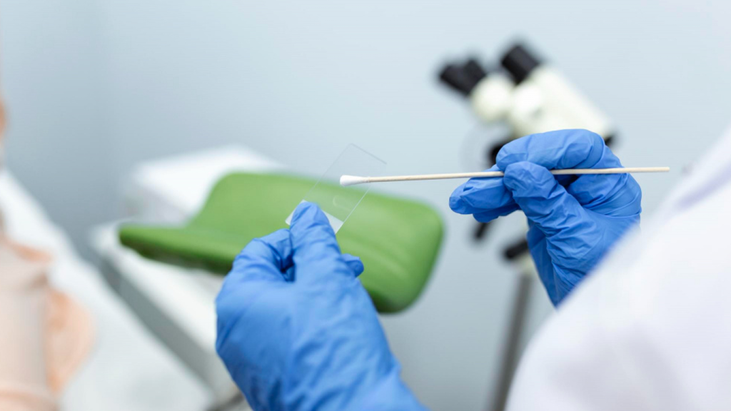 پاپ اسمیر کی انجام میشود