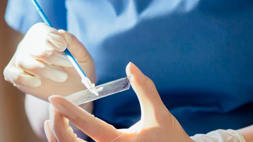 پاپ اسمیر کی انجام میشود