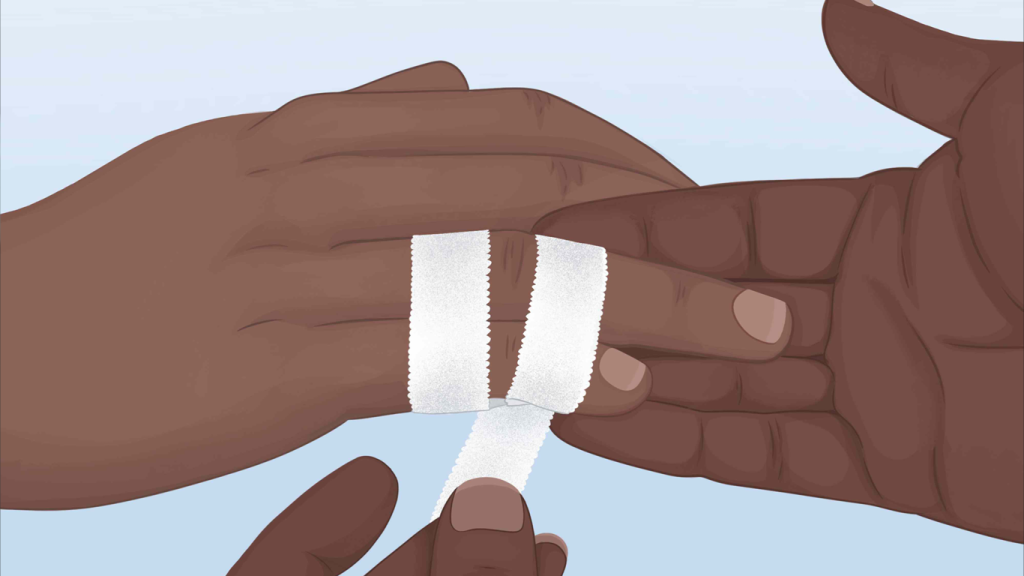 درمان در رفتگی انگشت دست در خانه