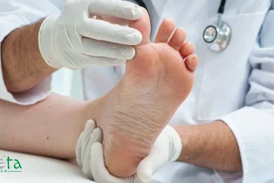 علائم در رفتگی انگشتان پا