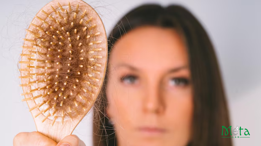 ریزش مو در بانوان