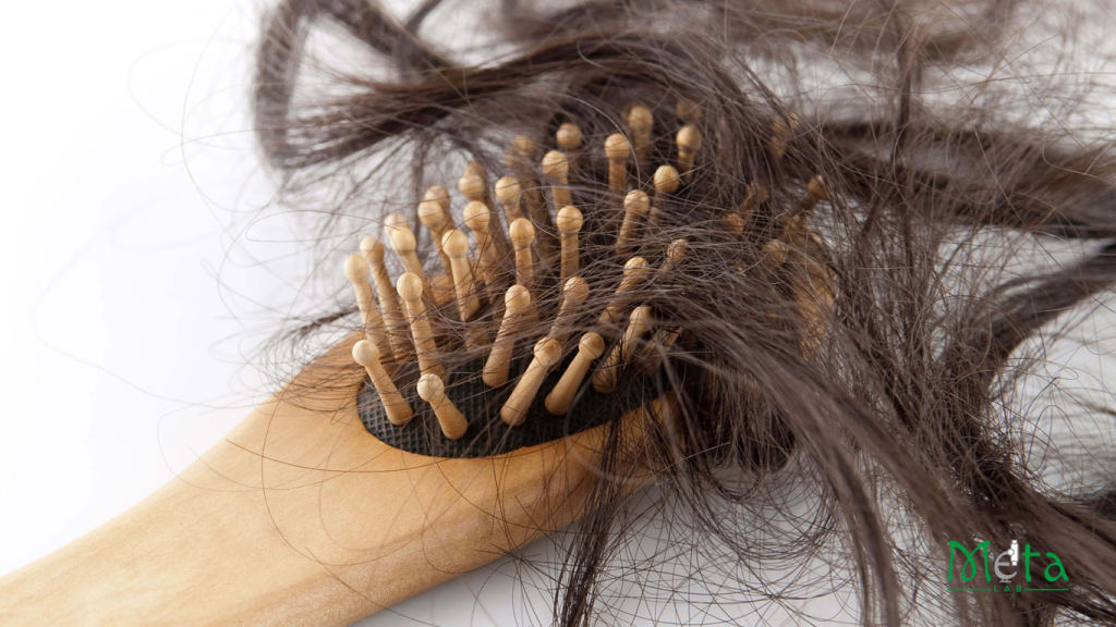 ریزش مو در بانوان