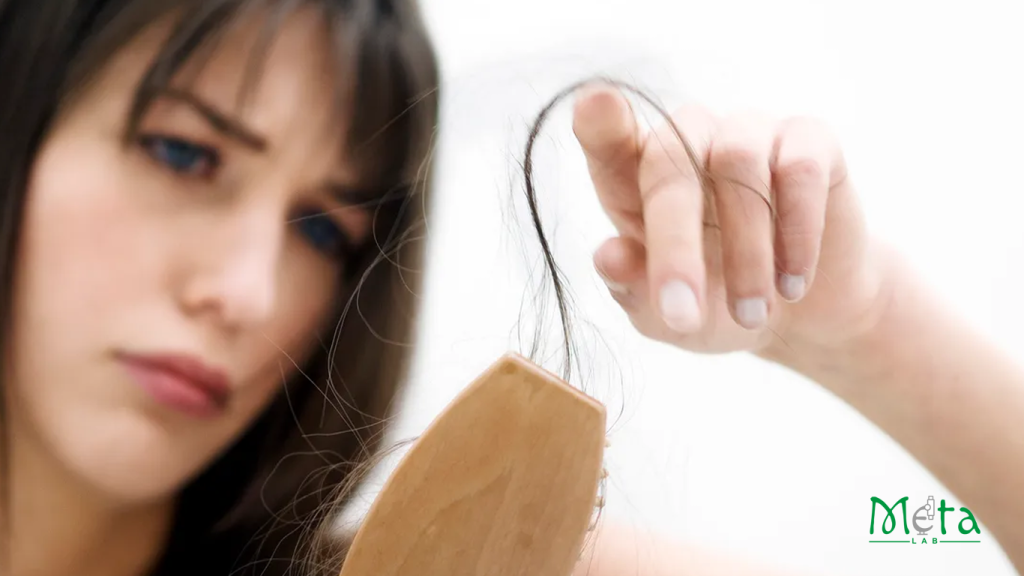 ریزش مو در بانوان